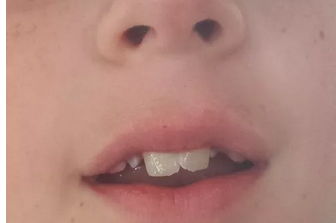 点击放大